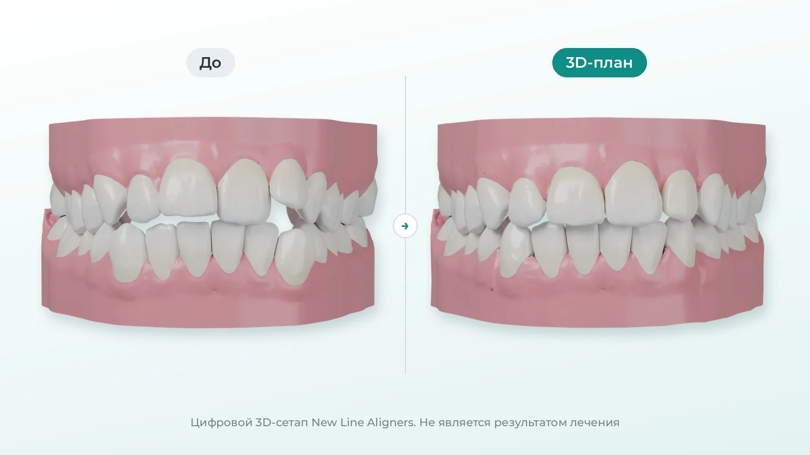 Цифровой 3D-сетап: вид спереди, до и 3D-план